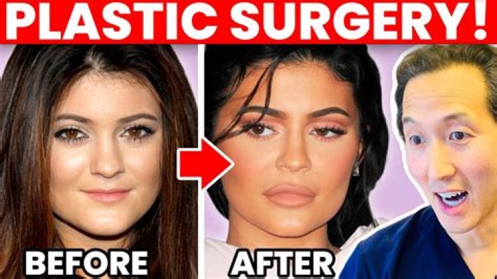 
Has Farrah Abraham Had Plastic Surgery? Who is Farrah Abraham? 