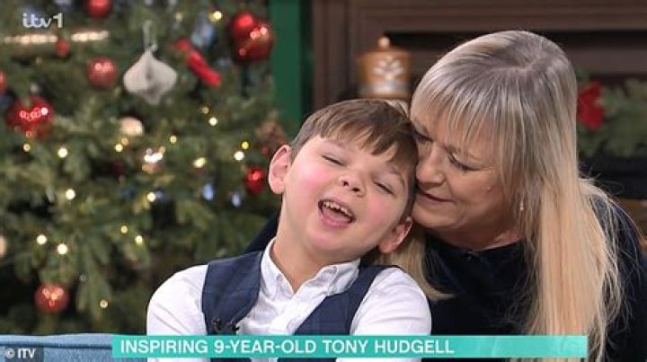 
Tony Hudgell Story Makes Everyone Emotional- What Exactly Happened To The Evil Parents After Getting Caught? 